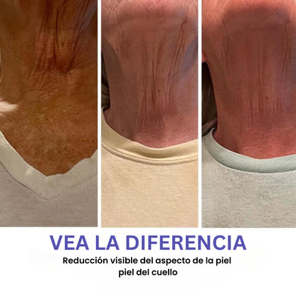 VITELLE™ Crema Reafirmante