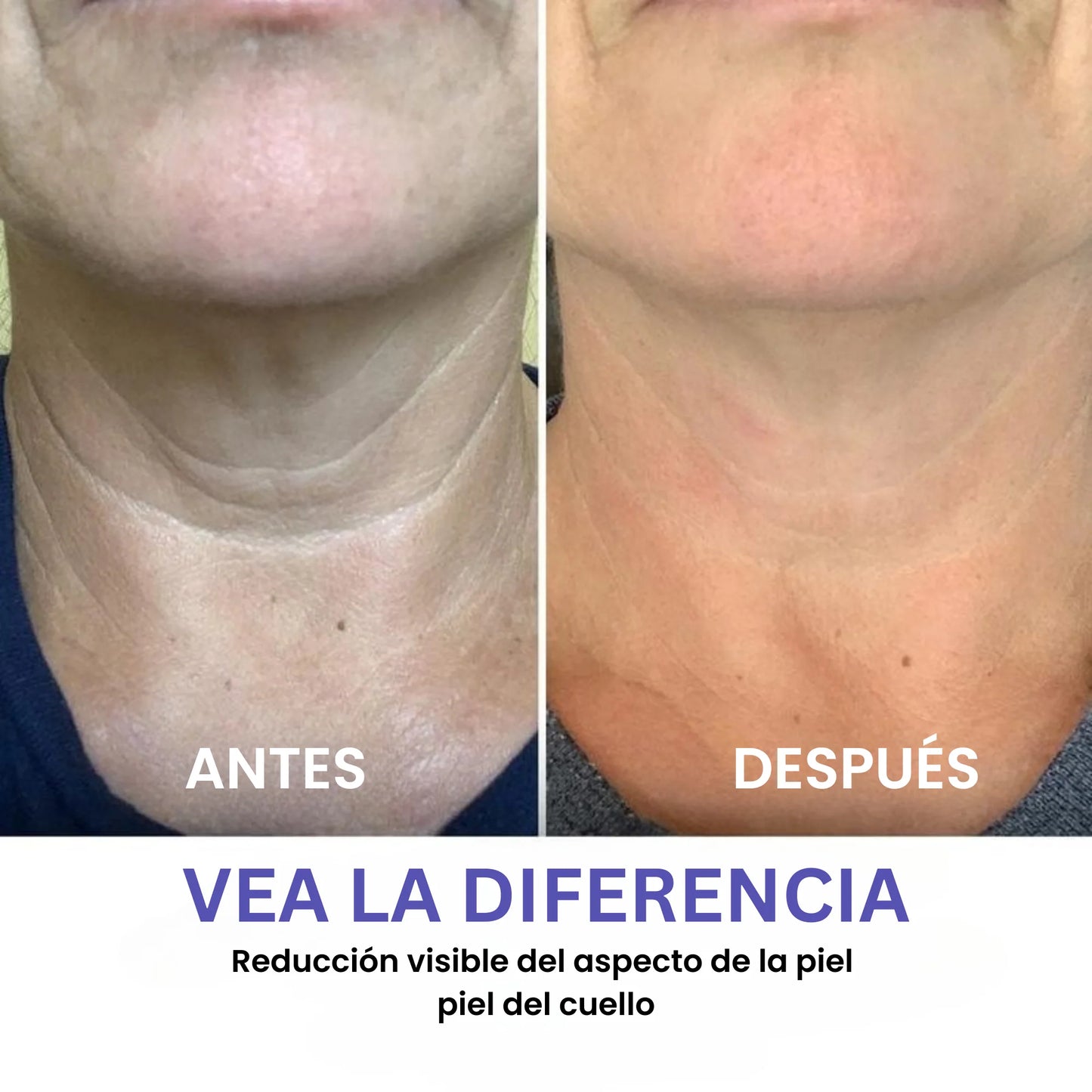 VITELLE™ Crema Reafirmante